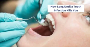 How Long Until a Tooth Infection Kills You