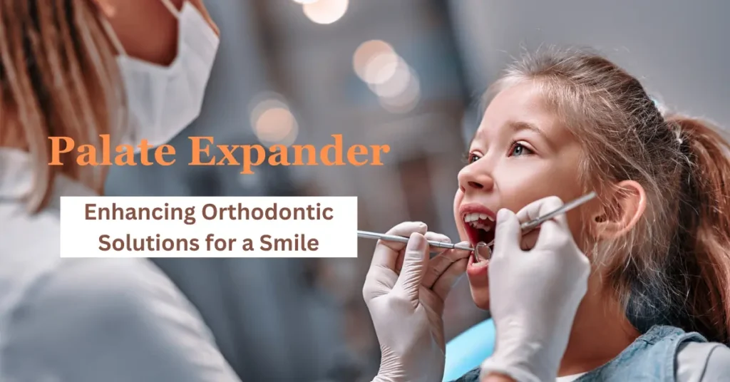 Palate Expander Enhancing Orthodontic Solutions for a Smile